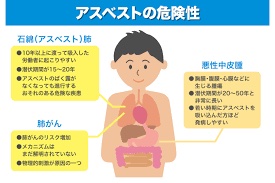 アスベスト危険性